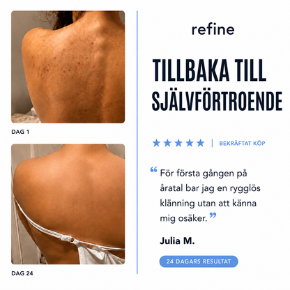 Refine™ Anti-Akne Kroppstvål