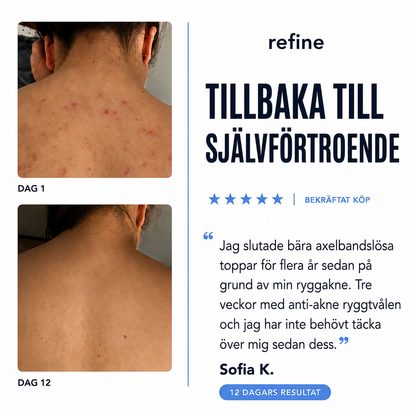 Refine™ Anti-Akne Kroppstvål