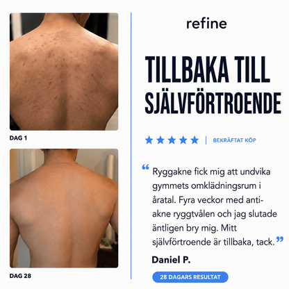 Refine™ Anti-Akne Kroppstvål